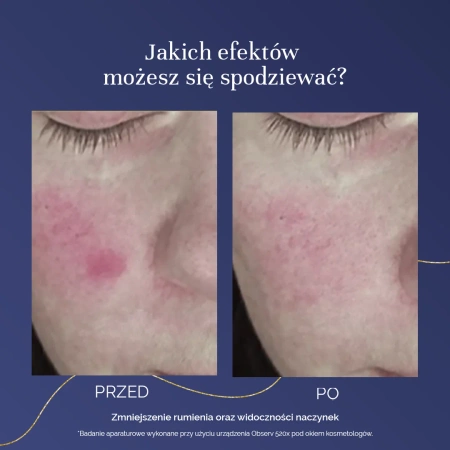 MyBestCollaGEN suplement na wsparcie kondycji skóry 150 kaps.