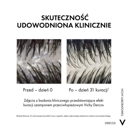 Vichy Dercos szampon przeciwłupieżowy z odżywką 2w1 200ml
