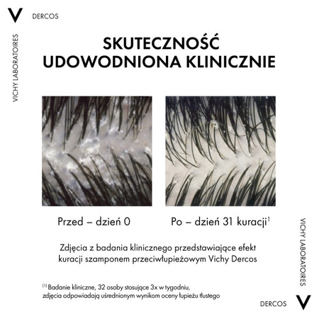 Vichy Dercos Szampon łupież suchy 390 ml