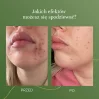 MyBestComplement koncentrat wspomagający odnowę i regenerację 250 ml